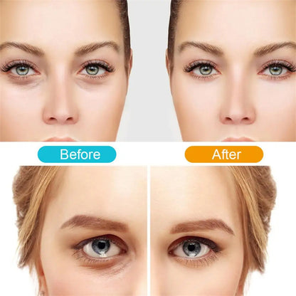 3d Eye Massager